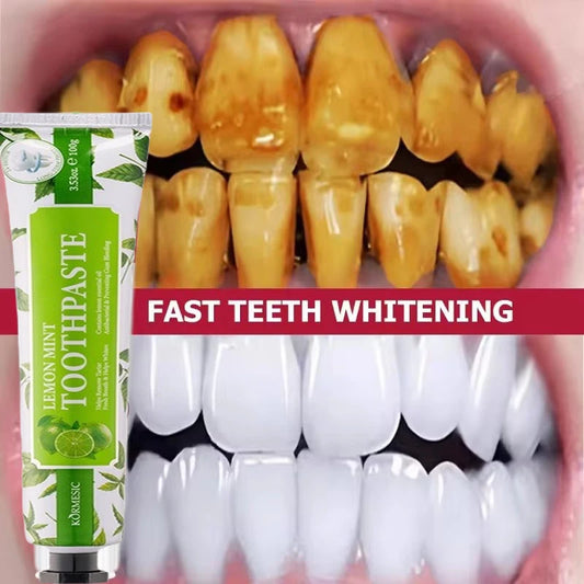 100g Probiotic Toothpaste Lemon Mint Whitening Tooth Remove Plaque Stains Teeth Whitener Oral Hygiene Clean Fresh Breath Dental